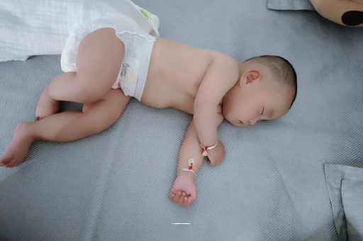 桂林六个月宝宝眼睛散光